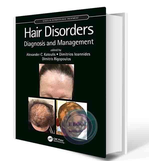 دانلود کتاب Hair Disorders: Diagnosis and Management (Series in Dermatological Treatment) 1st 2021 (ORIGINAL PDF)